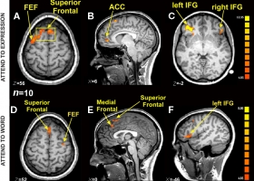 fMRI brain scan, 2010 (Source: Wikipedia Commons) fMRI brain scan, 2010 (Source: Wikipedia Commons)